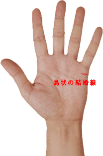 占い　手相　結婚線　島